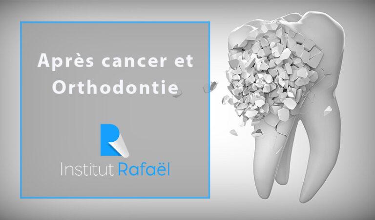 Orthodontie et après cancer