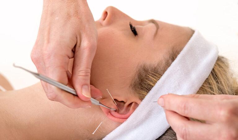 Présentation de l&rsquo;auriculothérapie et de ses bienfaits sur l&rsquo;organisme